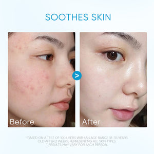 [Pre-sale]5X Ceramide Soothing Calming Essence Toner
