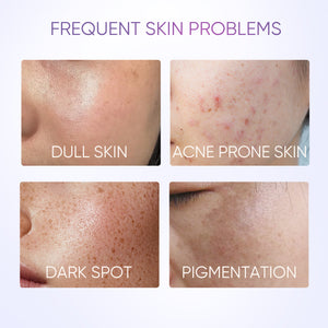 [Pre-sale]Symwhite 377 Dark Spot Serum
