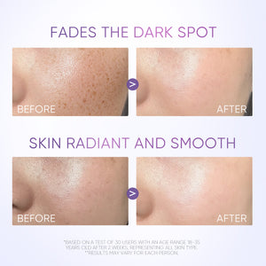 [Pre-sale]Symwhite 377 Dark Spot Serum