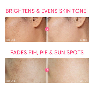 5PCS! Glowing Set