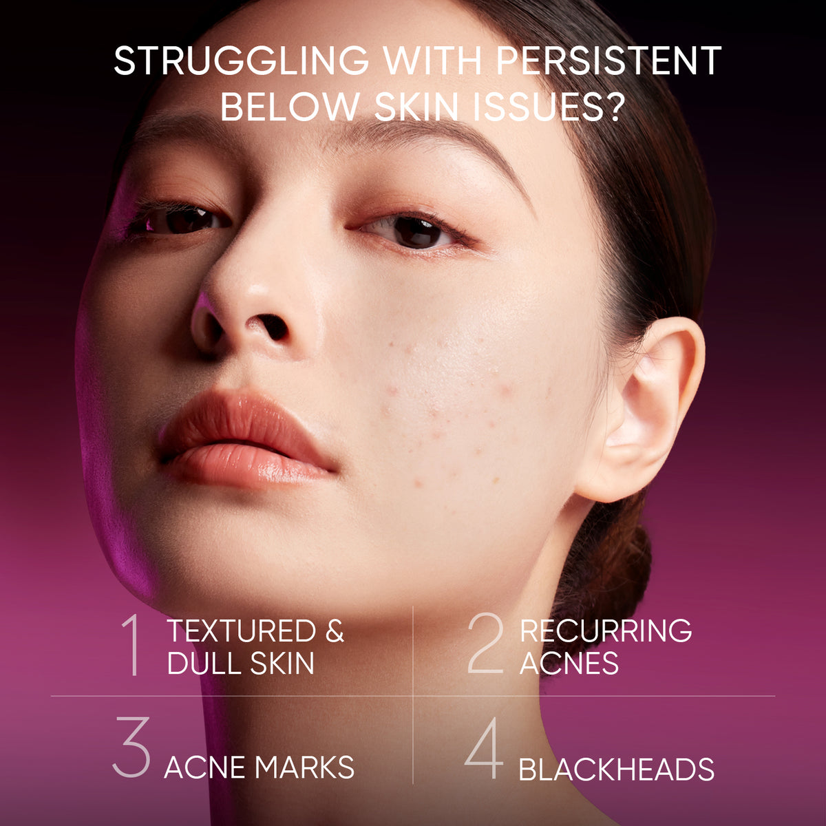 Larutan Pengelupasan Asam 12% Serum Glowing