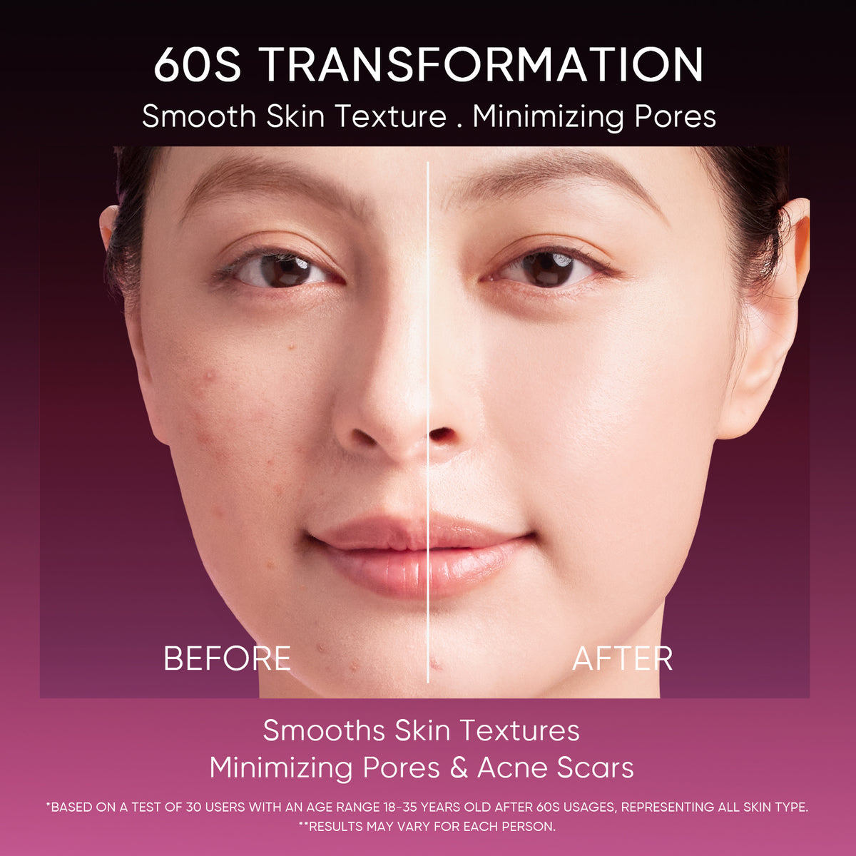 Larutan Pengelupasan Asam 12% Serum Glowing