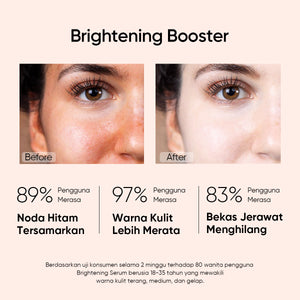 [Pre-sale]MSH Niacinamide Brightening Serum
