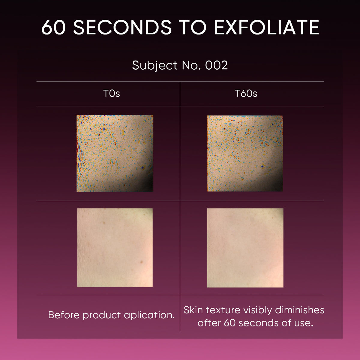 Larutan Pengelupasan Asam 12% Serum Glowing