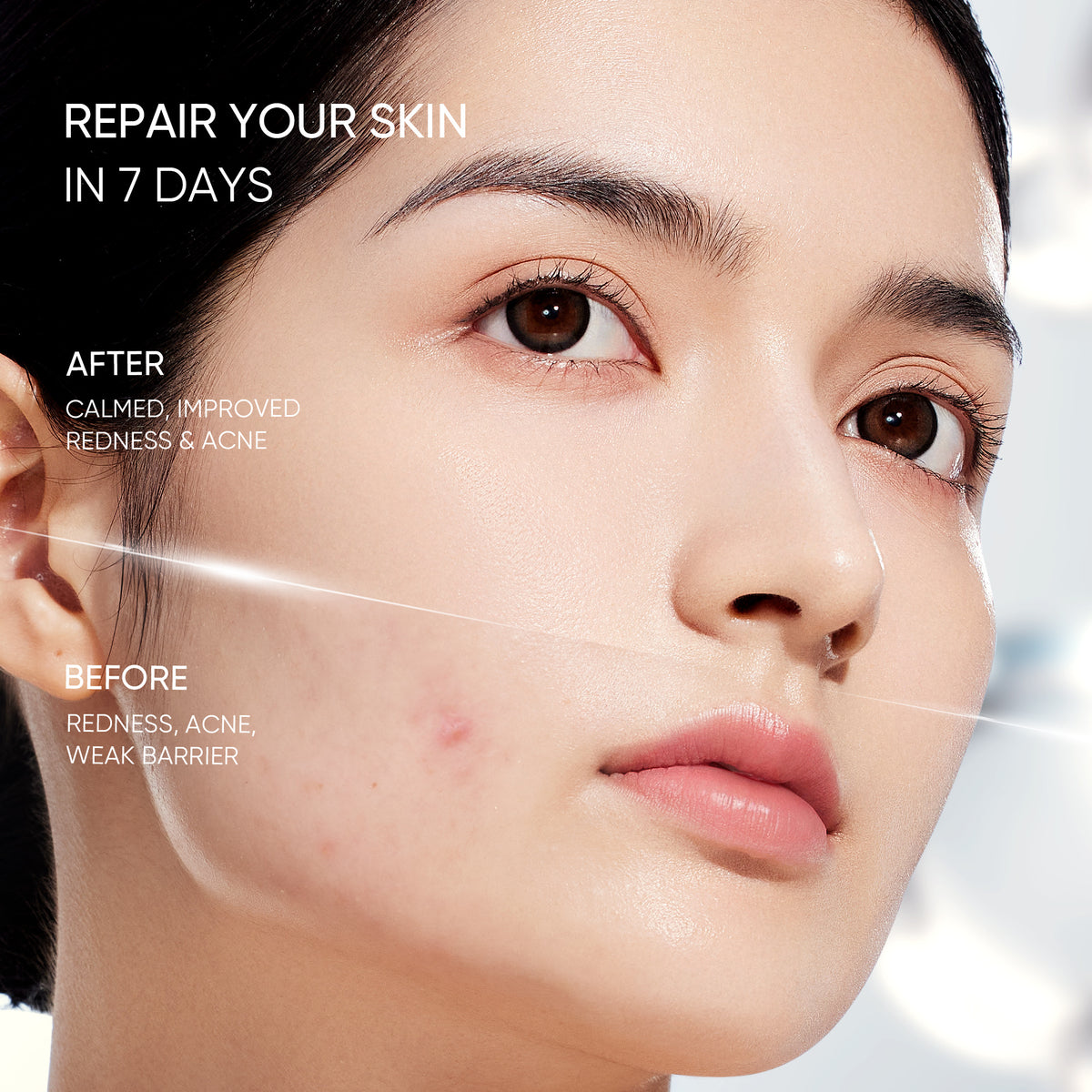 Sensitive Moisture Gel