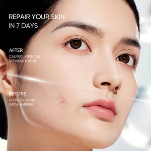 Sensitive Moisture Gel